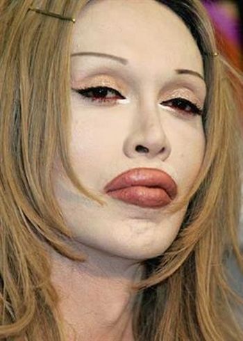 pete burns