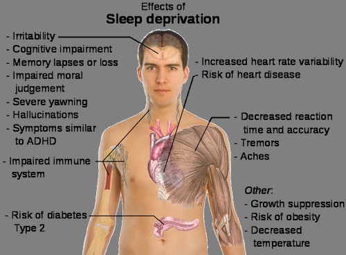 sleep deprivation