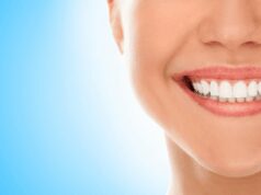 Discover the Best Dental Implants in Dallas for a Radiant Smile